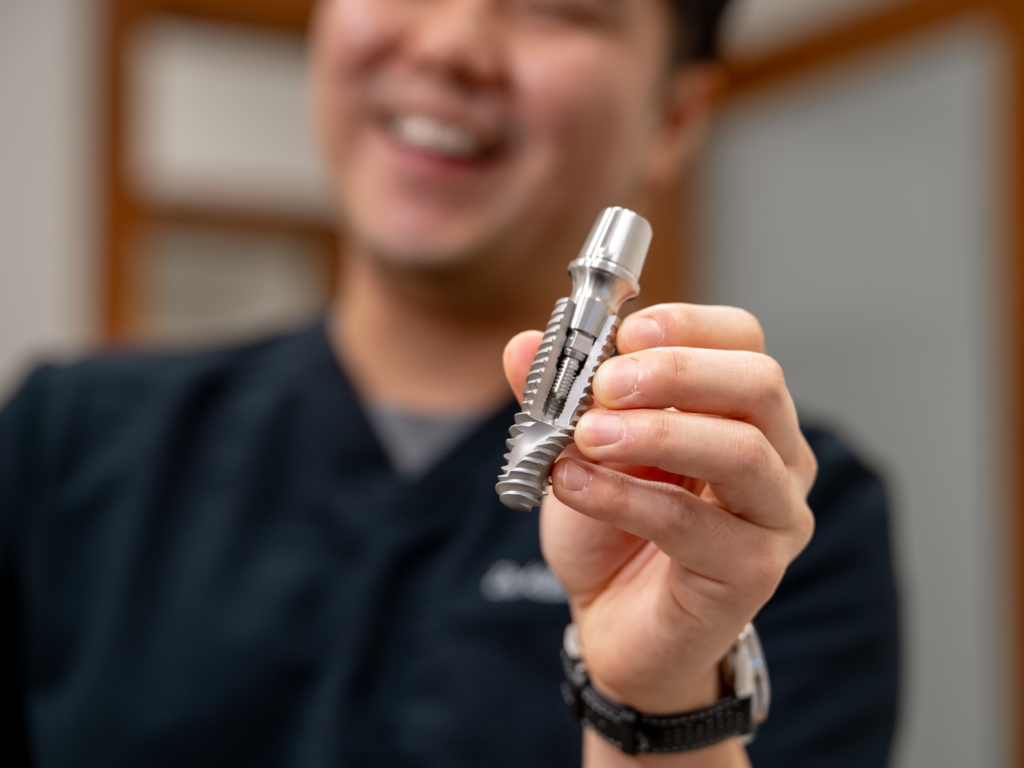 Dental implant model shown while smiling during a patient consultation for bone grafting